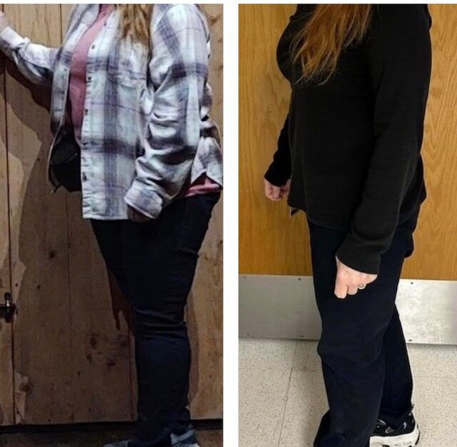 Weight Loss, before and after